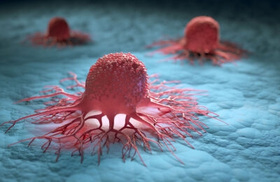 Group of isolated cancer cells - 3d illustration